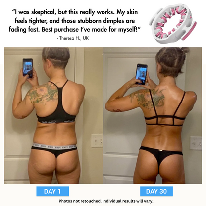 Lumoxa™ - MyoGlide Pro