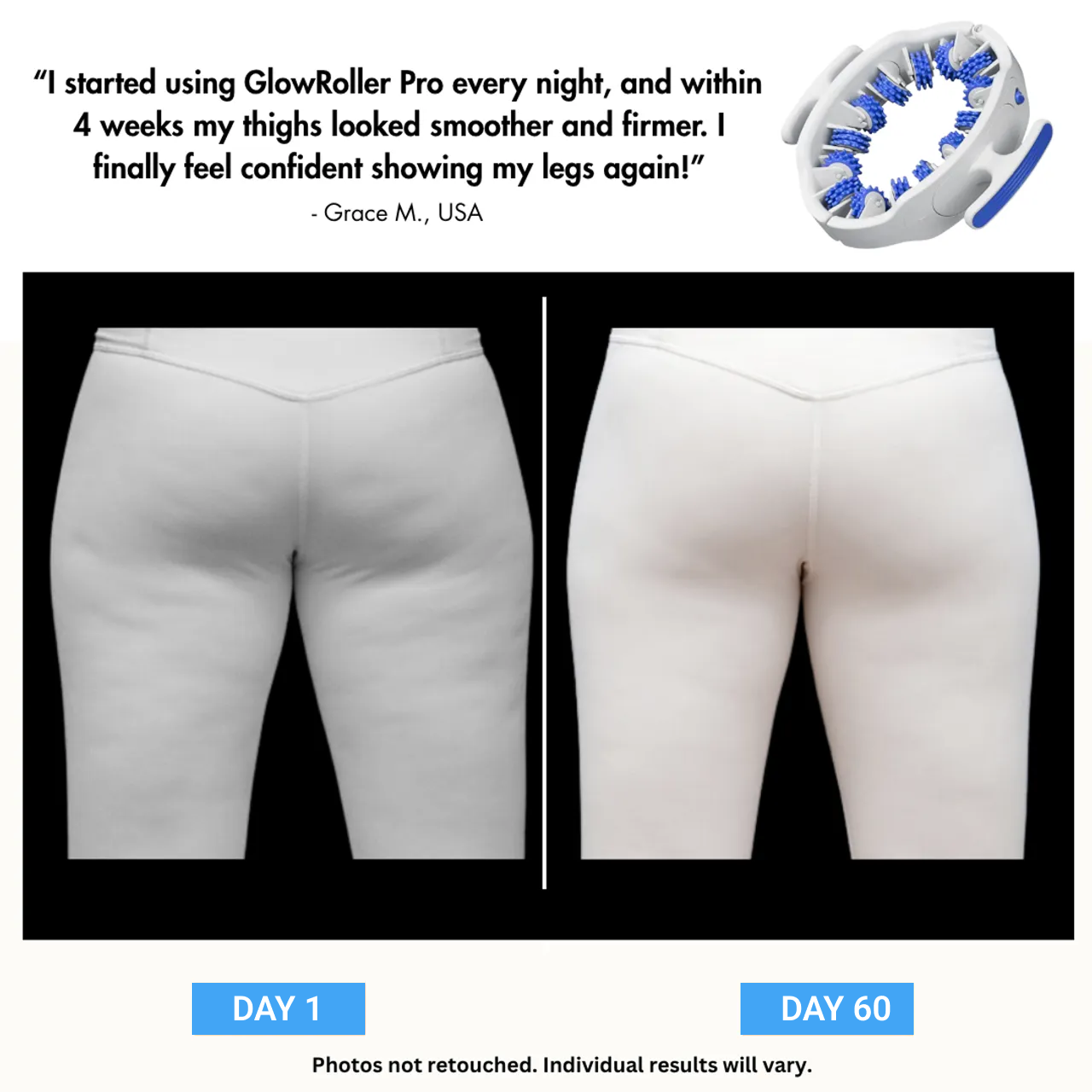 Lumoxa™ - MyoGlide Pro