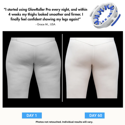 Lumoxa™ - MyoGlide Pro